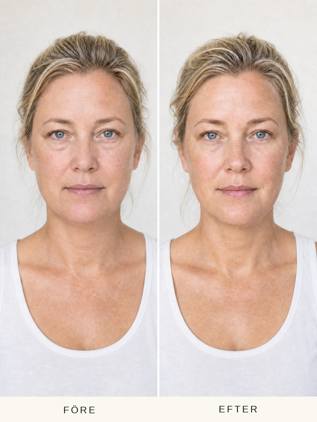 Före och efter – resultat från ett test med suki ansiktsborste på en kvinna. Individuella resultat kan variera.