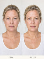 Före och efter – resultat från ett test med suki ansiktsborste på en kvinna. Individuella resultat kan variera.